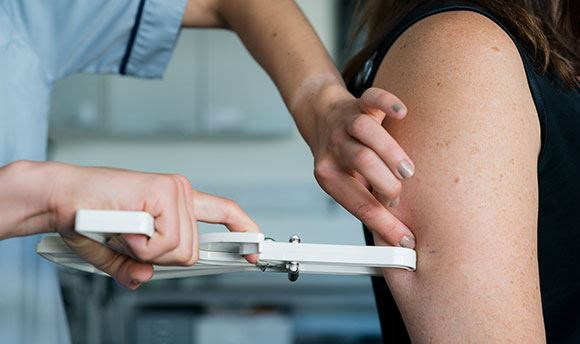 Close up of a dietician measuring the fat on an arm with a fat caliper 
